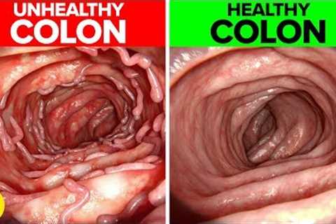 14 Life Changing Ways To Keep Your Colon Healthy